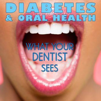 Lexington dentist, Dr. Alisha Patel of Hamburg Family Dental, discusses the side effects of diabetes and how it affects your oral health.