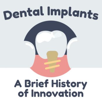 Lexington dentist, Dr. Alisha Patel of Hamburg Family Dental discusses dental implants and shares some information about their history.