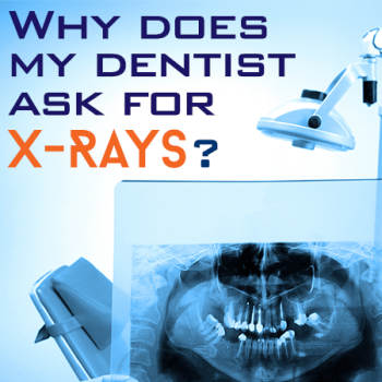 Lexington dentist, Dr. Alisha Patel at Hamburg Family Dental, discusses the importance of dental x-rays for accurate diagnosis and treatment planning.